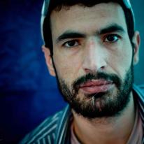 Kiarash Bahari with Sewn-closed-lips
