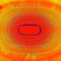 Radiation