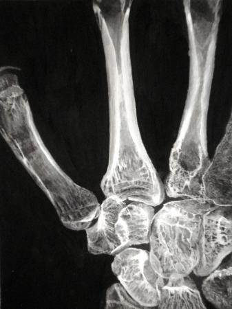 hand