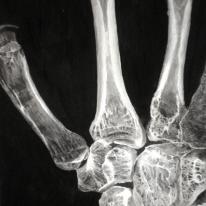 hand