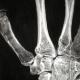 hand