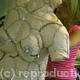 Scarred Venus 2003 | | | Ilestomy bags, Surgeon's sutre materials Scarred Venus 2003