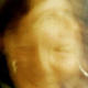 Self Portrait (visiting…