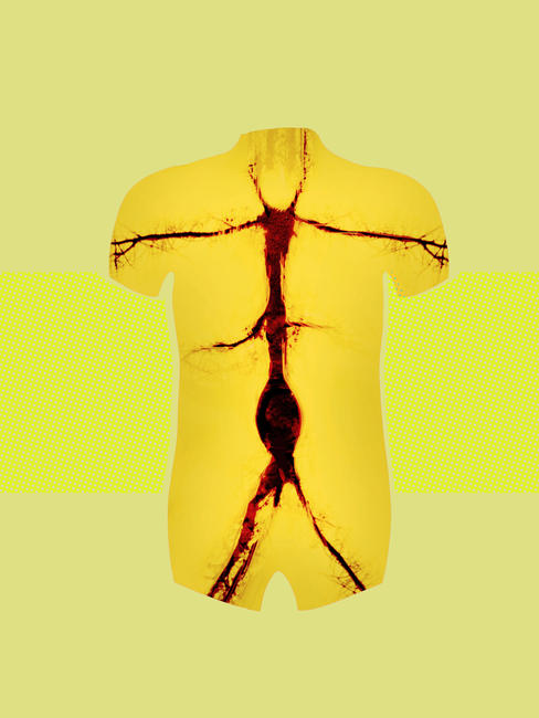 Aortic