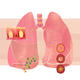 Bronchitis (book cover…