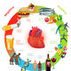 CVD (textbook illustration)