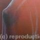 Breast [1]