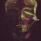 SKULLY [ex-Sinusitis…