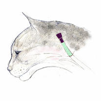 hidden oesophageal feeding…