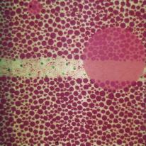 Big dots, little dots